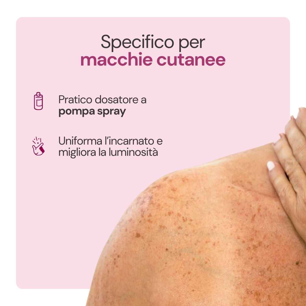 Spray per macchie cutanee