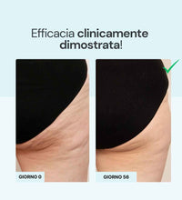 Crema cellulite effetto fresco