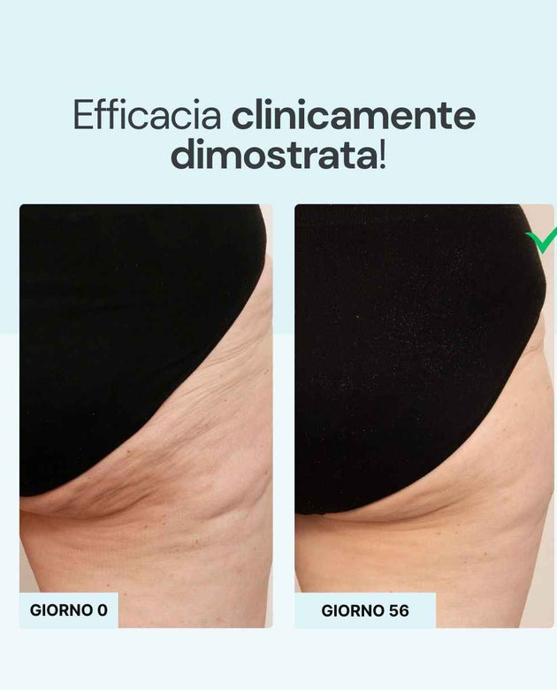 Crema cellulite effetto fresco